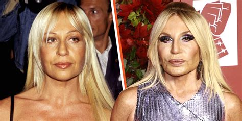 Donatella Versace's Plastic Surgery Transformations 